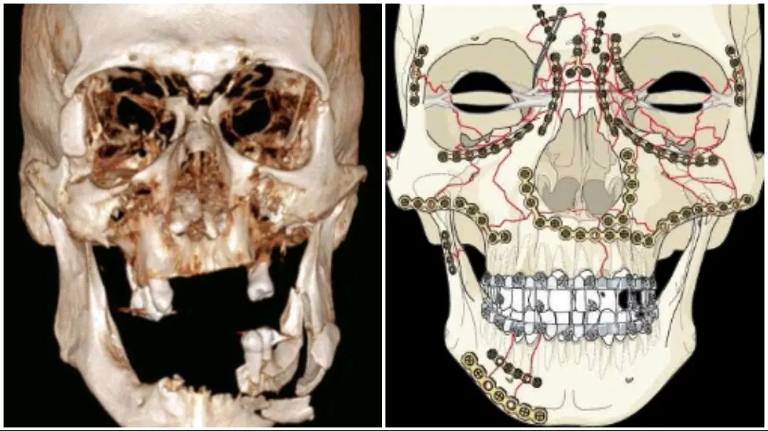 Facial trauma treatment in Kolkata